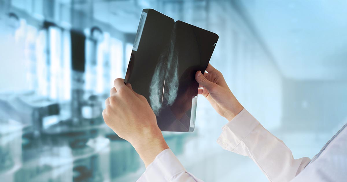Read more about the article Mammogram Screening: What Age to Start and Why Timing Matters More Than You Think